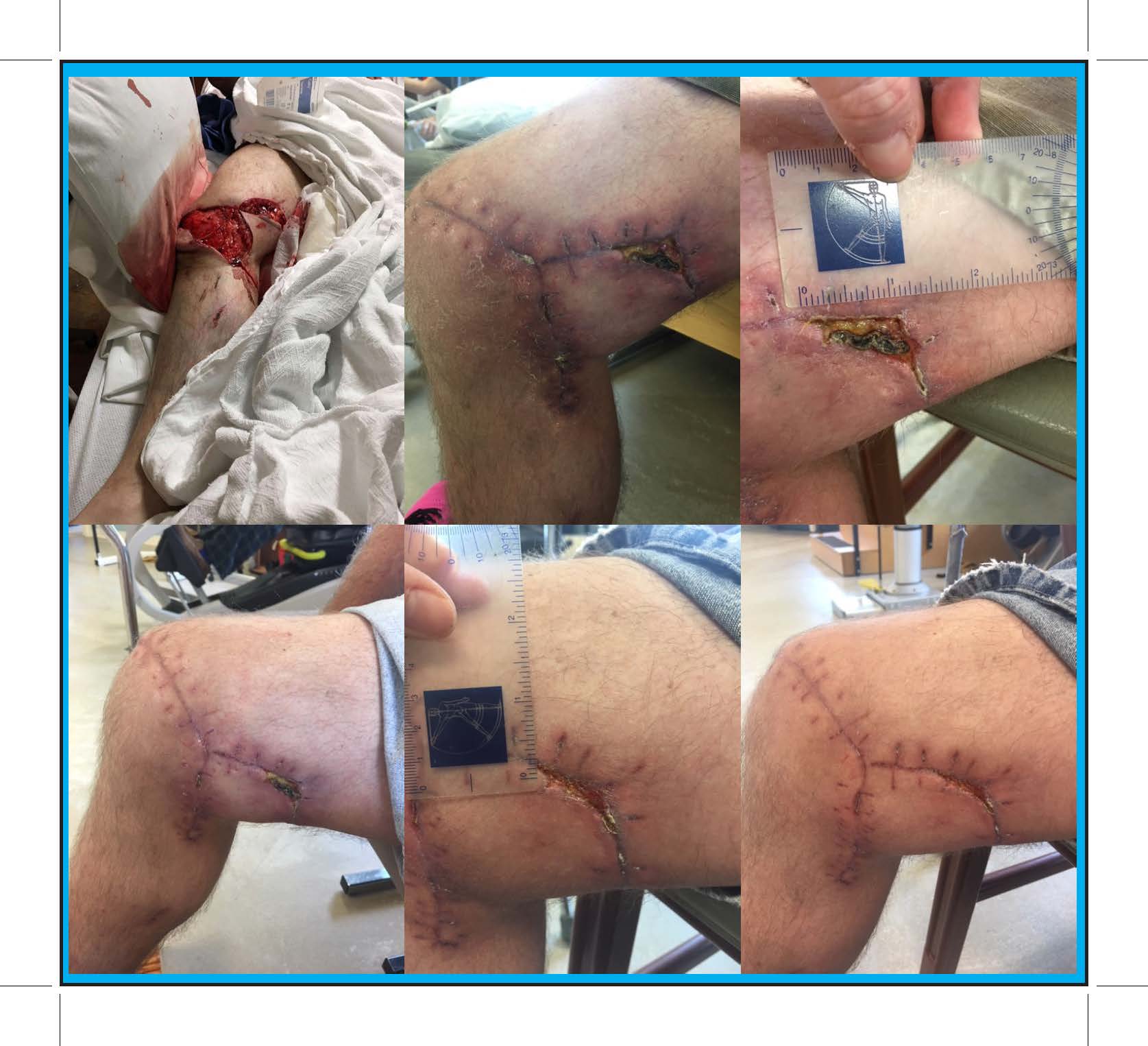 DAN – Wound Care PIC 1-6 TEMPLATE