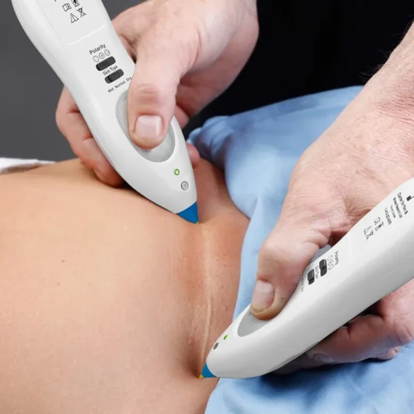 MPS SCAR RELEASE THERAPY